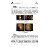 解放军总医院眼科医学部病例精解 李朝辉 陶海 金鑫 主编 内容包括病历摘要诊疗经过病例分析等9787523521519 科学技术文献出版社 商品缩略图4