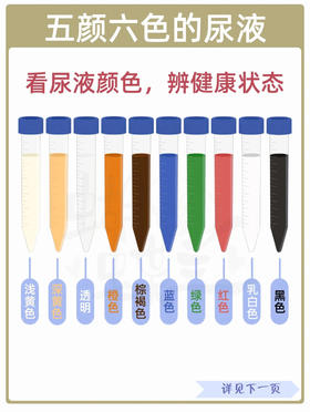 【科普】运动完尿液为什么是黄色的？出现这三种情况你就要注意了 
