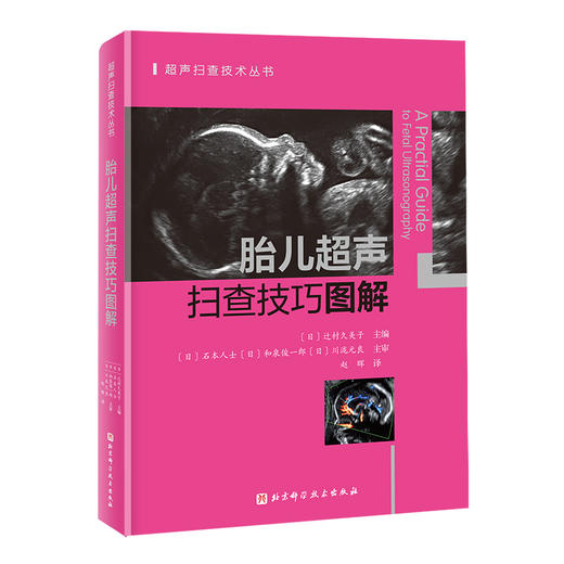 胎儿超声扫查技巧图解 商品图0