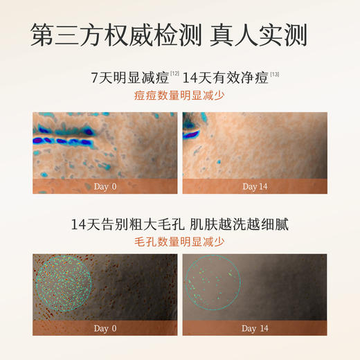 【分肤定制/敏感肌可用】【双旦|年终会员日】半亩花田氨基酸泡沫洗面奶洁面乳慕斯敏感肌男女士学生专用官方正品 商品图1