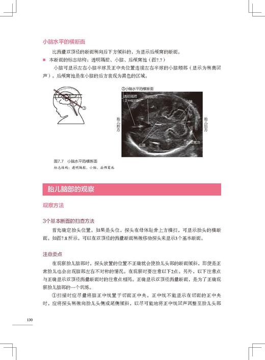 胎儿超声扫查技巧图解 商品图2