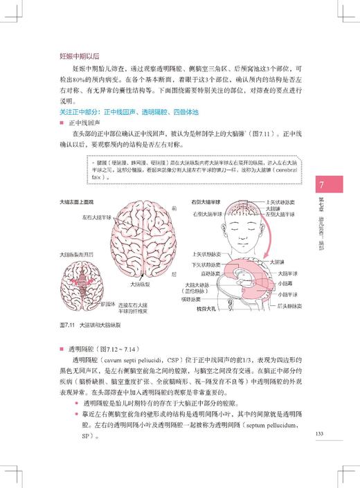 胎儿超声扫查技巧图解 商品图4