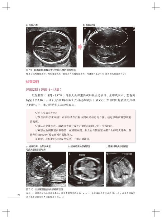 胎儿超声扫查技巧图解 商品图5