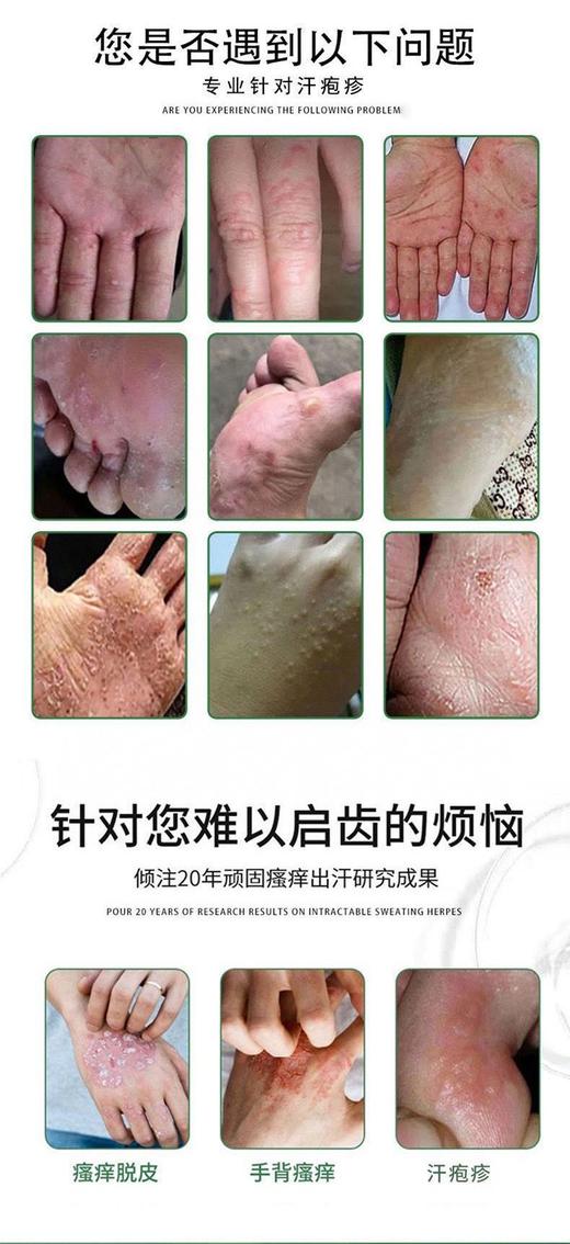 【泰国ManrubonsMken汗疱膏】皮肤问题的克星 天然植物成分必温和缓解不适☆轻松为肌肤保驾护航 纯草本抑菌配方，安全不刺激质地轻盈，一抹瞬间清凉止痒 商品图4