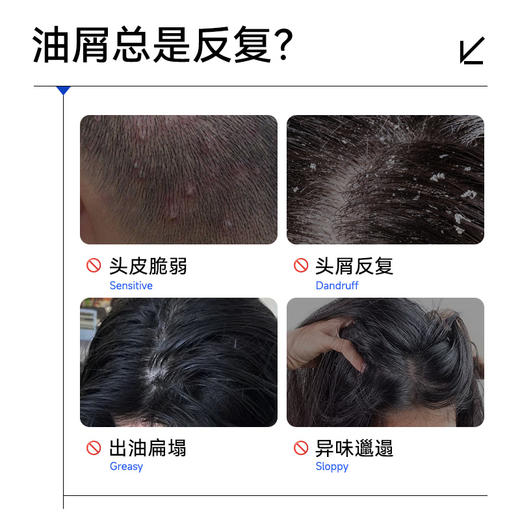 💠【升级】满婷氨基酸控油去屑洗发乳250ml和450ml——加入会员下单享8折，满69元送满婷清满保湿洁面乳，满119元送祛痘控油沐浴乳 商品图1