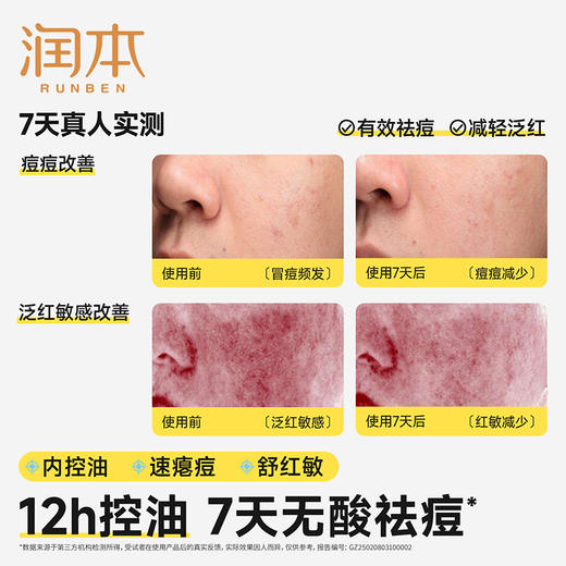 润本青少年控油祛痘精华水 褪红去闭口水粉刺快速舒缓痘印改善痘肌 商品图8