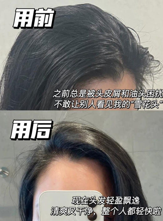 法国Vichy薇姿dercos无硅油止痒去屑温和洗发水绿标50ml/200ml/390ml 商品图4