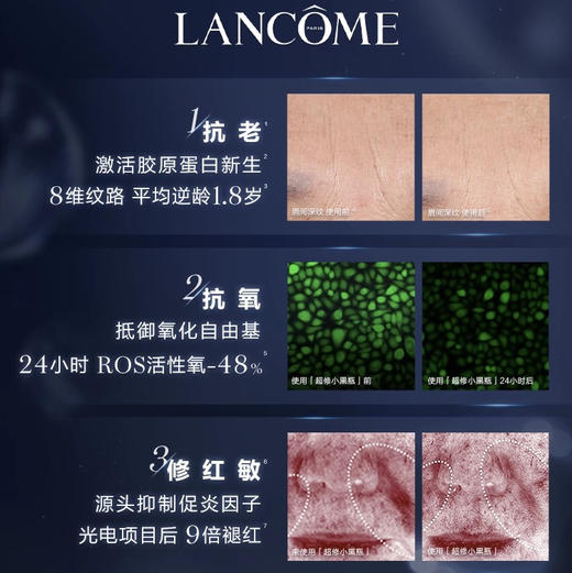 法国 LANCOME兰蔻 二代小黑瓶/三代超修瓶 面部精华肌底液  50ml /75ml / 100ml / 115ml 商品图6