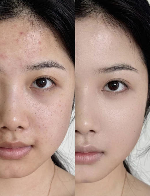 【5.24王炸割肉价】兰蔻遮瑕膏 14g 100# 110# 商品图5