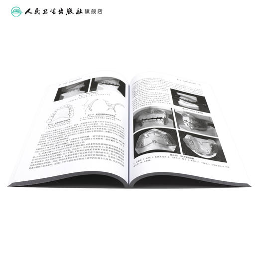 口腔正畸学（第4版）（“十三五“全国高职高专口腔医学和口腔医学技术专业规划教材） 商品图4