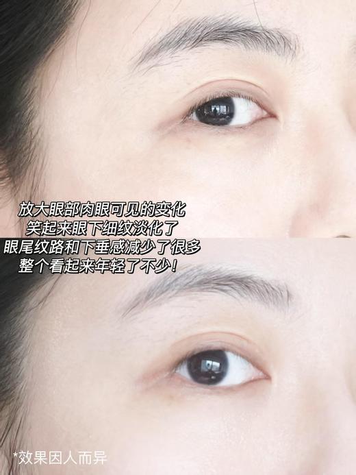 【5.24王炸割肉价】杜克修丽可多肽抗皱精华液15ml 商品图5