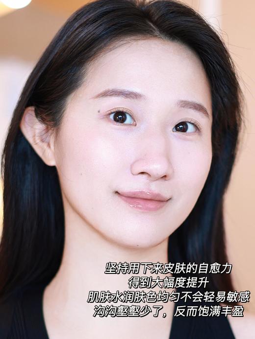 【10.1神价秒杀】兰蔻小黑瓶肌底液15ML 商品图4