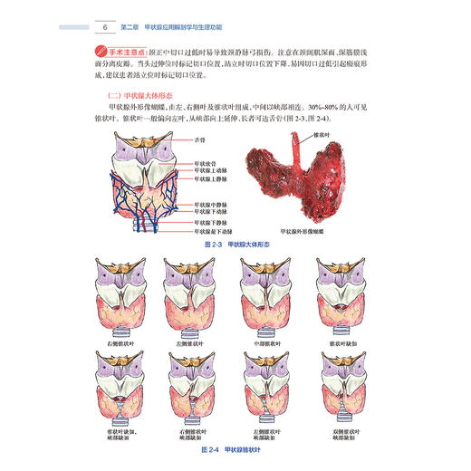 实用甲状腺手术图解 操作要领与技巧 吴高松 编 详细解读甲状腺手术各种术式各个操作步骤以及操作过程中的要点等 人民卫生出版社 商品图4