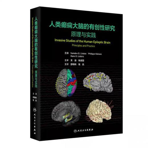 人类癫痫大脑的有创性研究 原理与实践 商品图0