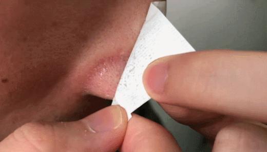 点击购买！柏翠丝茶树去黑头套装 商品图1