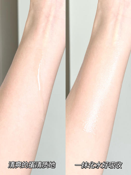 维稳NO.1的肌底精华【第三代兰蔻小黑瓶肌底液100ml】贵妇级护肤体验 让你重拾“少女肌" 促进后续精华5倍吸收心集万千优点于一身 商品图2