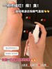【ESKE.泰国脚气喷剂】一喷终结脚丫烂、痒臭!再顽固的脚臭、痒、烂碰到它也会一扫而空 抑菌率高达99%!从根源彻底祛除不复发! 商品缩略图5