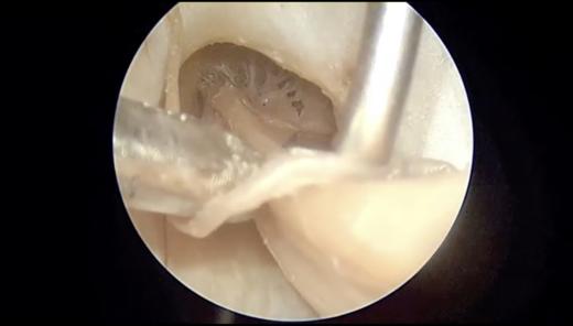标本的内听道解剖训练视频1 商品图0