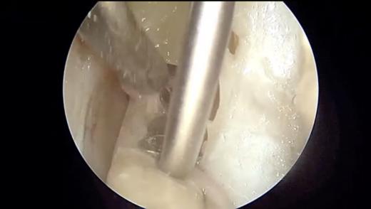 标本的内听道解剖训练视频2 商品图0