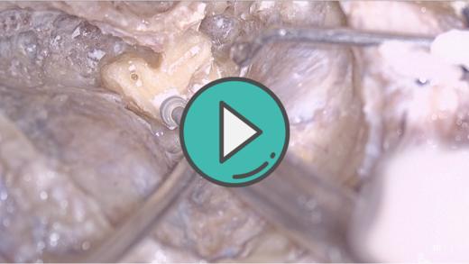 轮廓化半规管 视频 商品图0