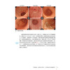 【出版社直发】胃炎的成因内镜诊断的历史与未来 寺尾秀一 自身免疫性胃炎和非幽门螺杆菌胃炎NHPH消化内科 辽宁科学技术出版社 商品缩略图3