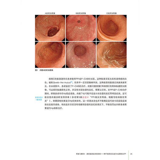 【出版社直发】胃炎的成因内镜诊断的历史与未来 寺尾秀一 自身免疫性胃炎和非幽门螺杆菌胃炎NHPH消化内科 辽宁科学技术出版社 商品图3