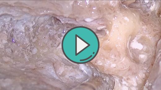 磨开半规管2D 商品图0