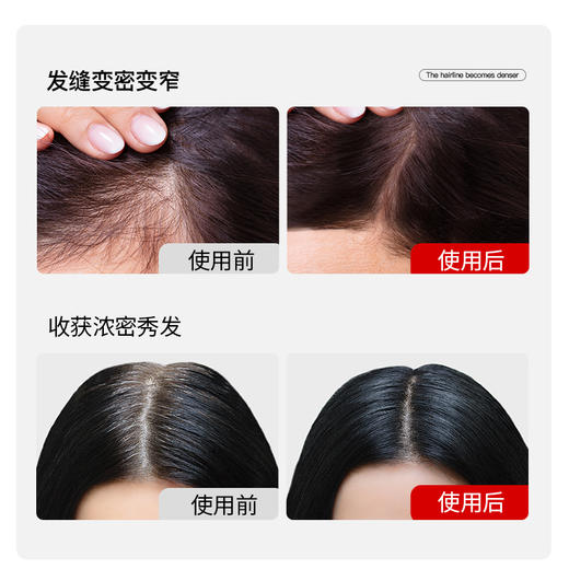 2025全新升级【克兰慕林 防脱发洗发水】侧柏叶防脱固发 咖/啡因专利成分 多种植物精粹 去油净头皮 水油平衡 清洁油脂 500ml/瓶 商品图3