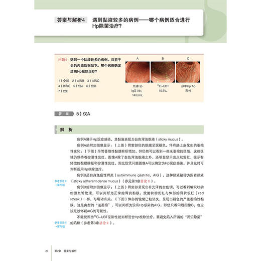 【出版社直发】胃炎的成因内镜诊断的历史与未来 寺尾秀一 自身免疫性胃炎和非幽门螺杆菌胃炎NHPH消化内科 辽宁科学技术出版社 商品图2