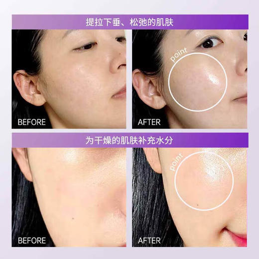 美蒂菲（MEDI-PEEL）九肽贴片面膜 5片【紧致抗皱】 商品图3