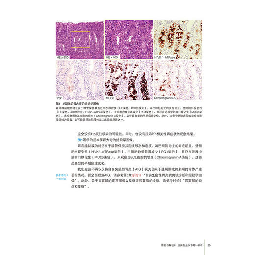 【出版社直发】胃炎的成因内镜诊断的历史与未来 寺尾秀一 自身免疫性胃炎和非幽门螺杆菌胃炎NHPH消化内科 辽宁科学技术出版社 商品图4