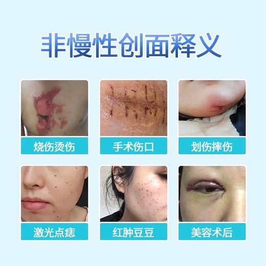 爱可欣医用液体敷料 商品图1