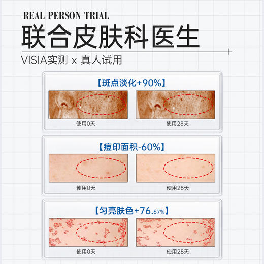【新品拍1加赠同款15支】复因FOY美白祛斑修护精华液1.5ml*30支 美白淡印祛斑 ***2件9折、3件8折 商品图4