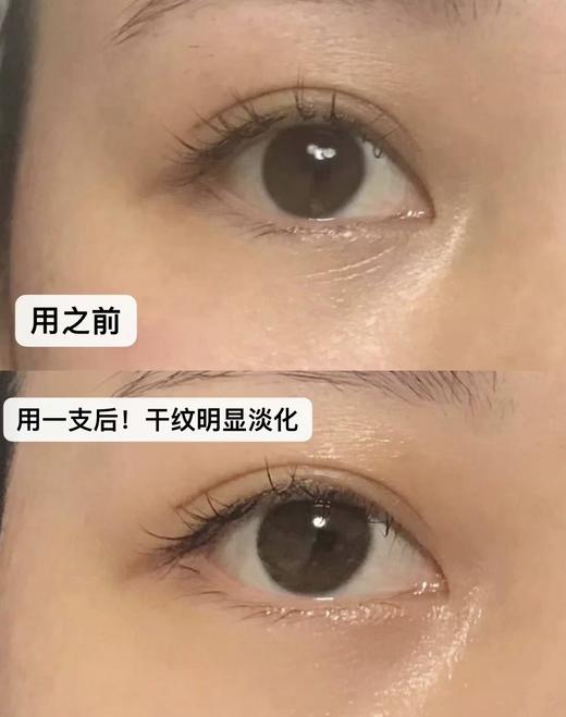 【7.26王炸割肉价】 伊丽莎白雅顿银级眼霜15ml（限25年10月） 商品图5