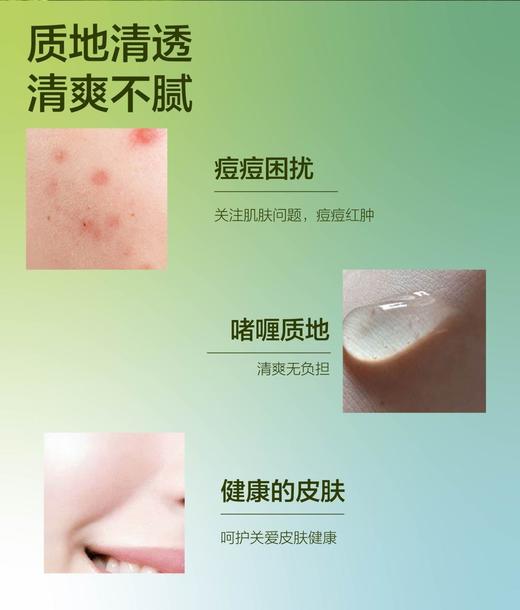 （器械号）苗天使完美芦荟胶  有效期20271004 商品图11