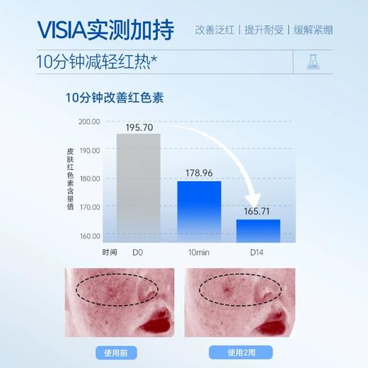 【复因】舒敏修红霜敏感肌速修面霜50g 舒缓补水保湿修护泛红屏障 商品图4