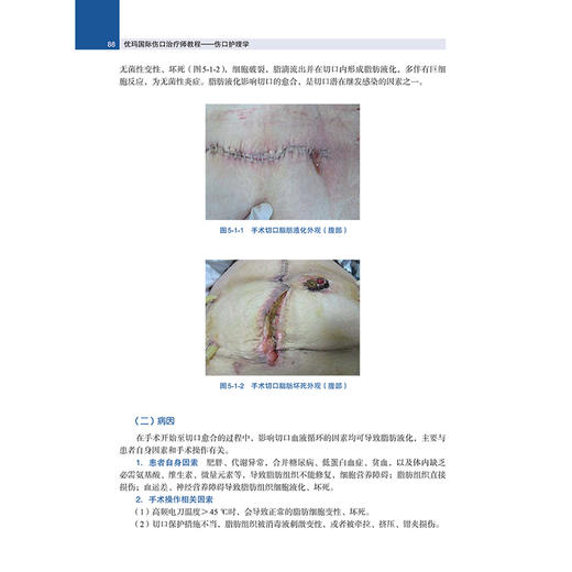 优玛国际伤口治疗师教程—伤口护理学 伤口护理评估及管理 鲁雪梅 王艺 中华医学电子音像出版社 9787830054861 商品图4