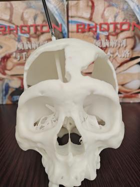 开颅手术定位穿刺颅骨模型，神外世界出品