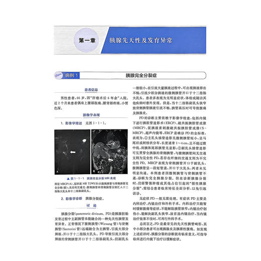 胰腺疑难与罕见病例：影像与病理 邵成伟 边云 蒋慧 精选135例胰腺疑难与罕见病例 深度融合影像与病理资料 上海科学技术出版社 商品图4
