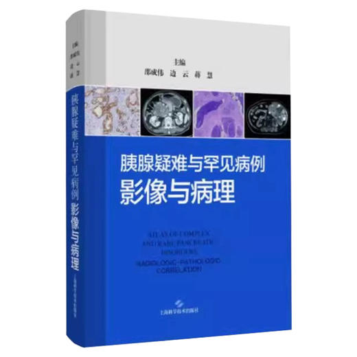 胰腺疑难与罕见病例：影像与病理 邵成伟 边云 蒋慧 精选135例胰腺疑难与罕见病例 深度融合影像与病理资料 上海科学技术出版社 商品图1