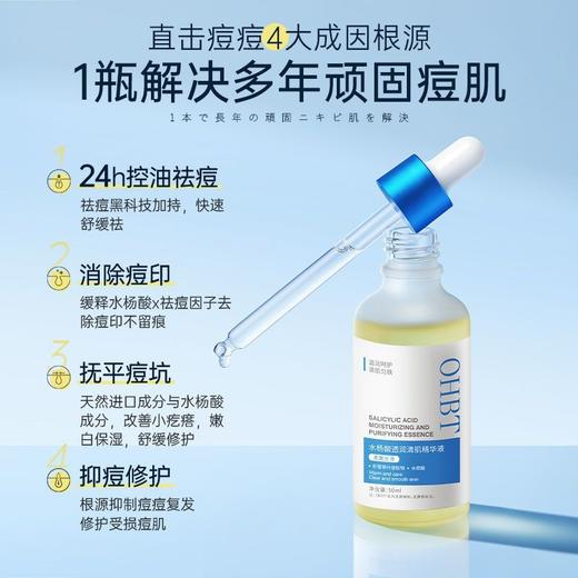 OHBT水杨酸祛痘精华液20%壬二酸淡化痘印收缩毛孔 商品图1