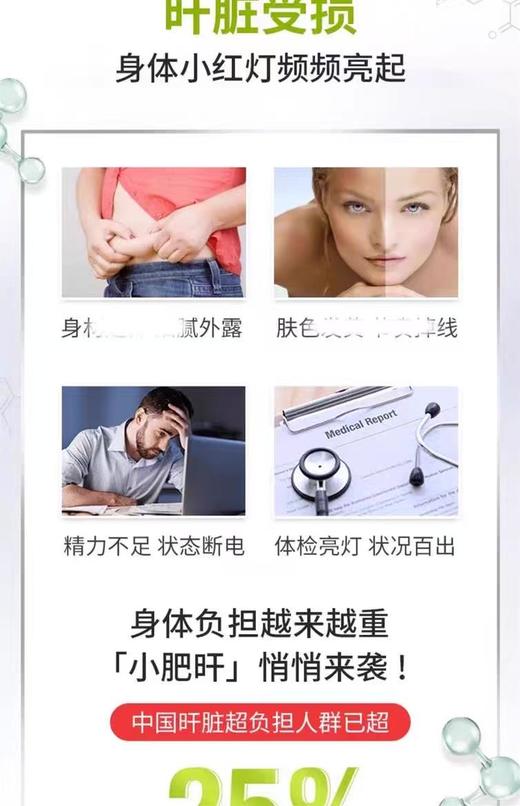 澳洲Swisse 护肝片高浓缩Plus加强版 奶蓟草滋补 熬夜70倍净化片 商品图2