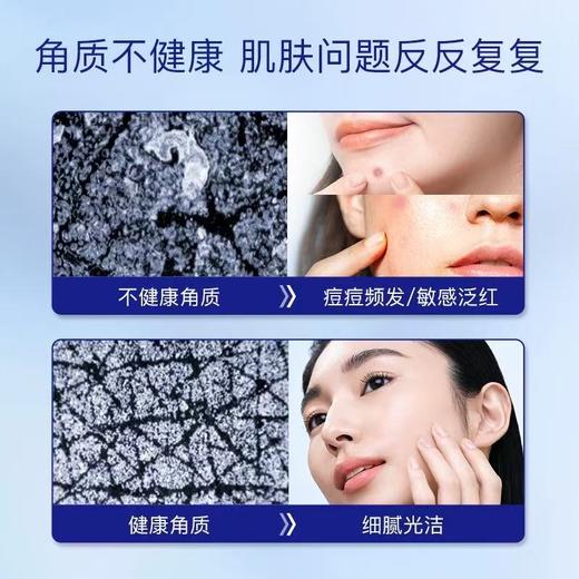 自用三年！嫩成豆腐！takami小蓝瓶祛痘修复精华液 去闭口 商品图2