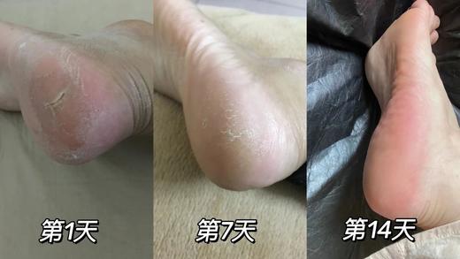 【多妈团购 布雷辛舒润足跟膏1瓶59，2瓶99】干裂/死皮/老茧一键重启，效果堪比“换皮”，软化角质+深度滋润+修护V更新+均亮肤色，一步到位-美初 商品图3