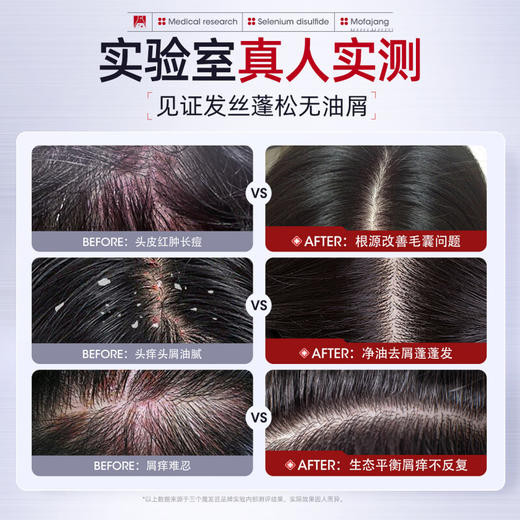 三个魔发匠二硫化硒控油去屑洗发水 商品图4