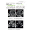 三维超声在产前诊断中的应用 第2二版 谢红宁 主译 阐述了三维超声成像的基本原理与实践方法 各种3D渲染工具等 人民卫生出版社 商品缩略图4