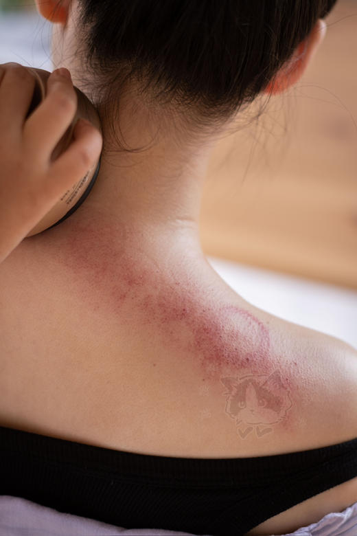 冬病夏治❗️拔罐+刮痧+脉冲三合一养生仪【金正电动刮痧拔罐仪】   ✅液晶屏显➕超长续航 商品图1