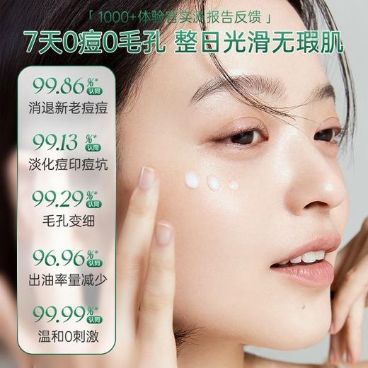 OHBT壬二酸精华霜祛痘膏控油去痘印粉刺黑头收缩毛孔提亮肤色保湿 商品图3