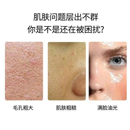 【女神狂欢嗨购】（一般贸易）科颜氏金盏花植物萃取控油精华爽肤水500ml/250ml补水舒缓【买一送一】 商品图3