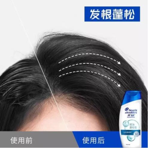 海飞丝去屑头皮护理洗发露 (控油蓬松型)80g 商品图4